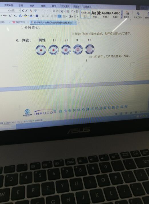 離心機(jī)好不好，現(xiàn)場實(shí)驗(yàn)見分曉